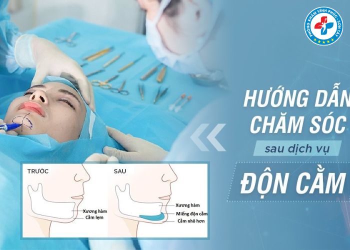 Độn cằm tại Vĩnh Phúc (5) Độn cằm tại Vĩnh Phúc (5)
