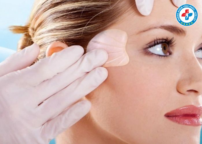 Độn thái dương tại Vĩnh Phúc (4)