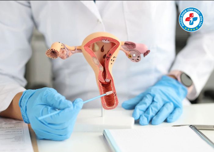 Khám phụ khoa là khám những gì Khám phụ khoa là khám những gì