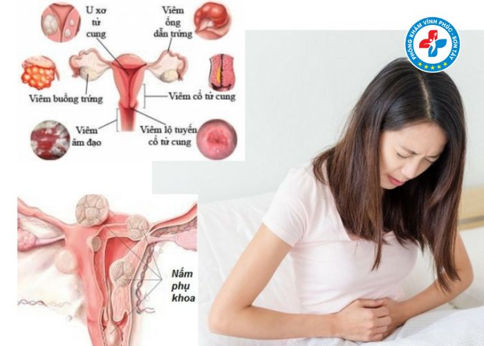 Khí hư màu nâu không mùi là bệnh gì (1) Khí hư màu nâu không mùi là bệnh gì (1)