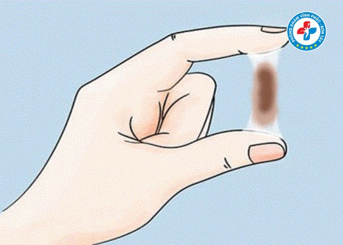 Khí hư màu nâu không mùi là bệnh gì (2) Khí hư màu nâu không mùi là bệnh gì (2)