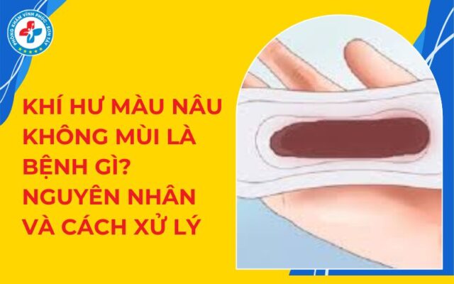 Khí hư màu nâu không mùi là bệnh gì