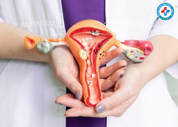 Mẹo trị ngứa vùng kín nhanh nhất (7) Mẹo trị ngứa vùng kín nhanh nhất (7)