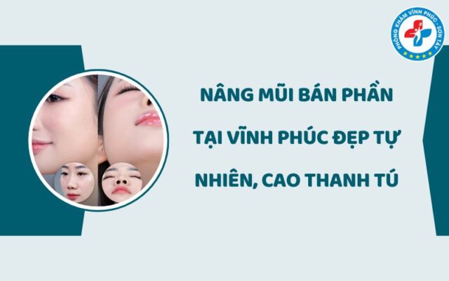Nâng mũi bán phần tại Vĩnh Phúc