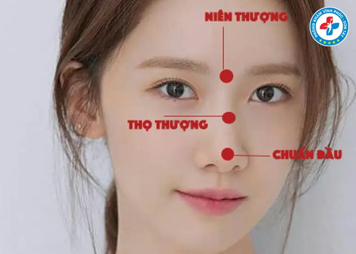 Thu gọn cánh mũi tại Vĩnh Phúc (2) Thu gọn cánh mũi tại Vĩnh Phúc (2)