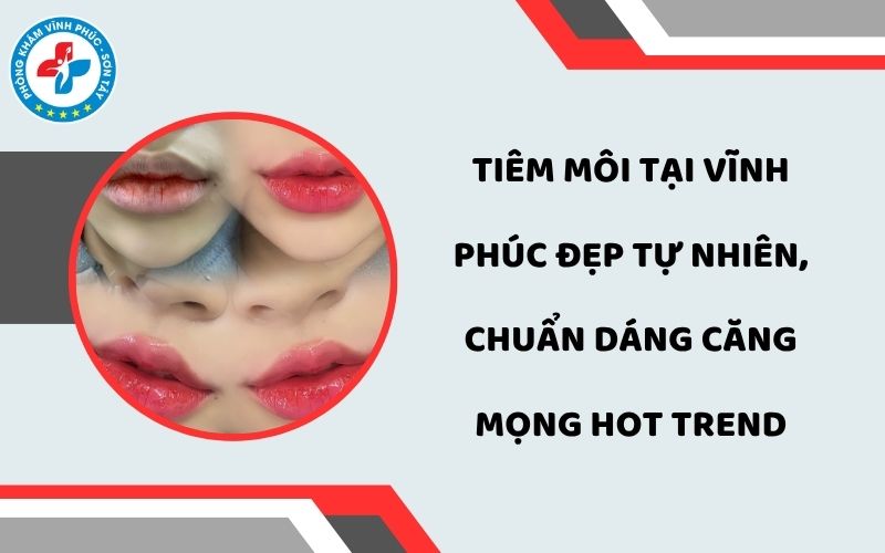 Tiêm môi tại Vĩnh Phúc