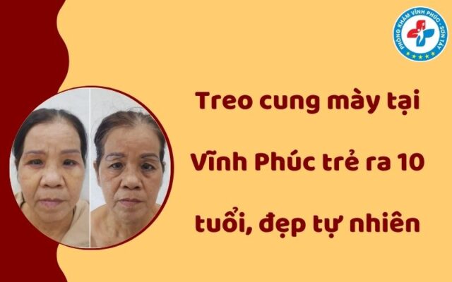 Treo cung mày tại Vĩnh Phúc