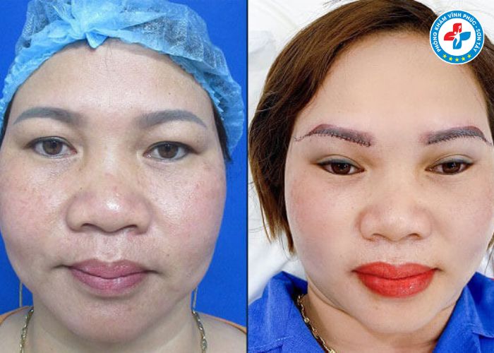 Treo cung mày tại Vĩnh Phúc (3) Treo cung mày tại Vĩnh Phúc (3)