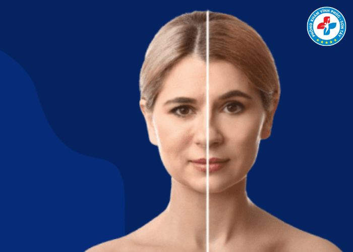 Treo cung mày tại Vĩnh Phúc (6) Treo cung mày tại Vĩnh Phúc (6)