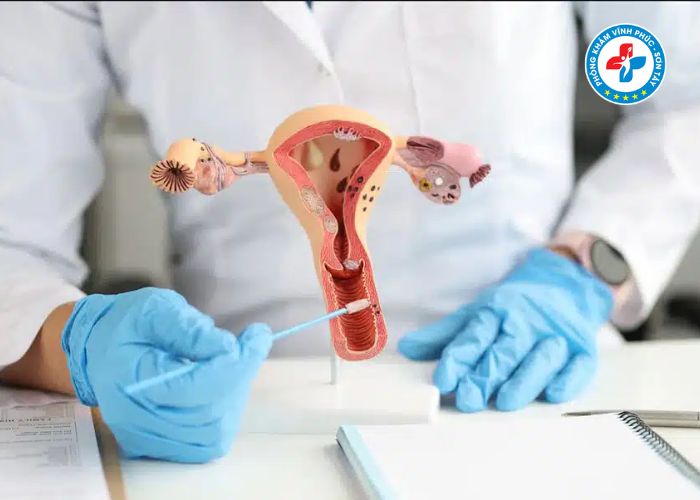dịch vụ khám phụ khoa trọn gói vĩnh phúc (6) dịch vụ khám phụ khoa trọn gói vĩnh phúc (6)